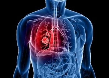 Ενημερωτική εκδήλωση στα Τρίκαλα για τις παθήσεις καρδιάς και θώρακος