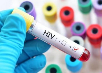 «Θέρισε» και το 2018 το AIDS