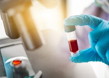 Στα 21 τα νέα κρούσματα του «κορωνοϊού» στην Ελλάδα