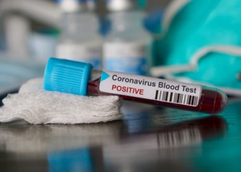 Άλλα 18 επιβεβαιωμένα κρούσματα του «κορωνοϊού»