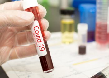 Ξεπέρασαν το «φράγμα» των 3.000 τα κρούσματα του «κορωνοϊού» στην Ελλάδα