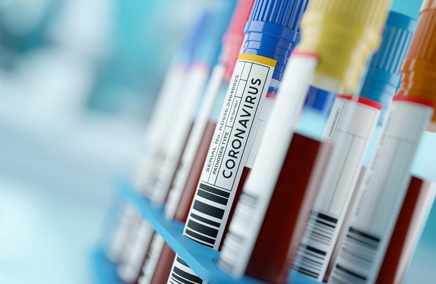 Στα 24 τα νέα κρούσματα «κορωνοϊού» στον Νομό Τρικάλων