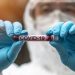 Ξεπέρασαν τα 2.500 τα επιβεβαιωμένα κρούσματα «κορωνοϊού» στον Νομό Τρικάλων