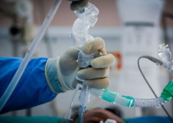 Στις ΜΕΘ της Ελλάδας με covid-19 διασωληνωμένοι 431 ασθενείς