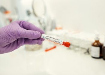 Αρνητικά όλα τα σημερινά Rapid Tests στην Καλαμπάκα