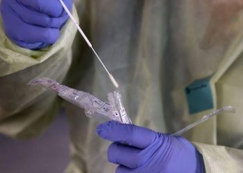 Για …επανέλεγχο 28χρονος Τρικαλινός