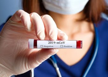 Στα 75 τα ημερήσια κρούσματα covid-19 στην Θεσσαλία