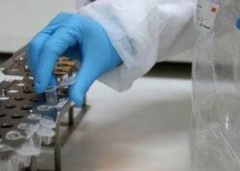 Στα 63 τα ημερήσια κρούσματα covid-19 στην Θεσσαλία