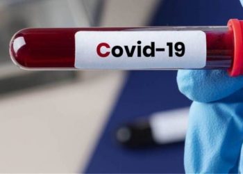 Στα 167 τα ημερήσια κρούσματα covid-19 στην Θεσσαλία
