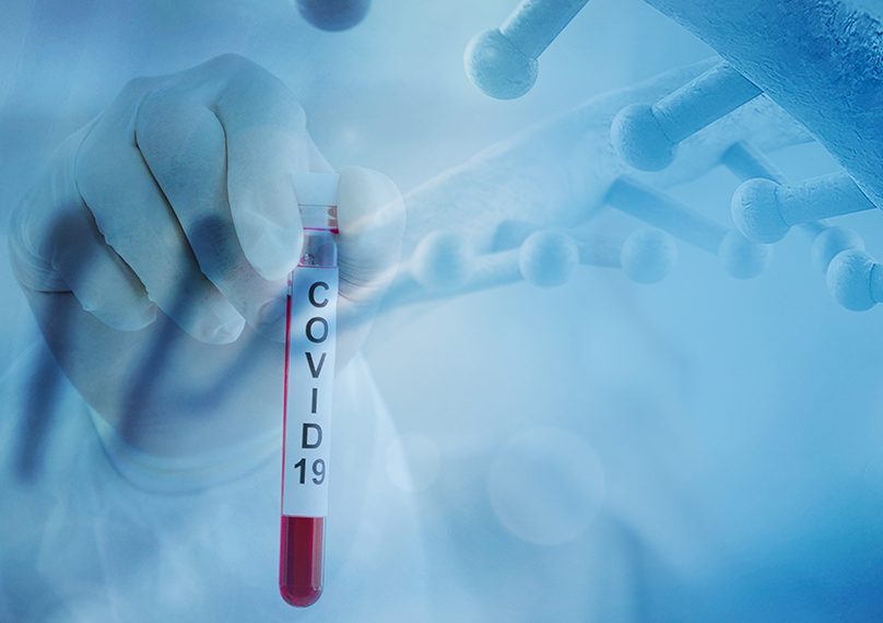 Στα 21 τα ημερήσια κρούσματα covid-19 στον Νομό Τρικάλων