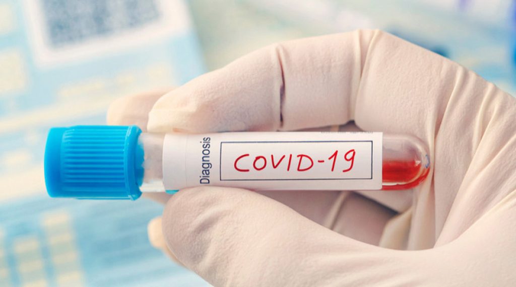 Στα 133 τα ημερήσια κρούσματα covid-19 στην Θεσσαλία
