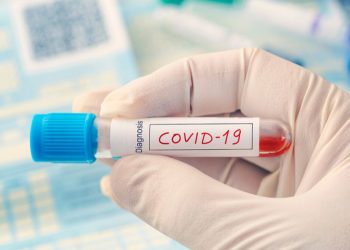 Στα 133 τα ημερήσια κρούσματα covid-19 στην Θεσσαλία