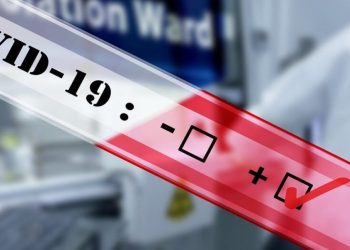 Στα 151 τα ημερήσια κρούσματα covid-19 στην Θεσσαλία