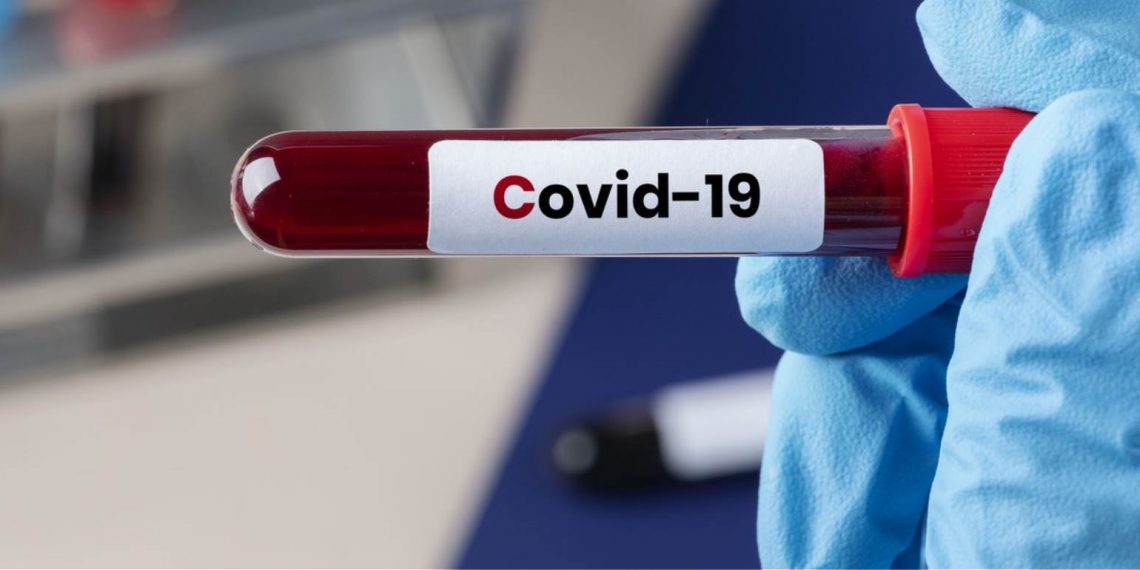 Στα 24 τα ημερήσια κρούσματα covid-19 στον Νομό Τρικάλων