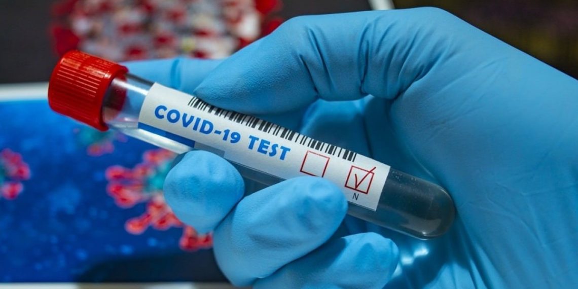 Πρόγραμμα ελέγχων ανίχνευσης covid-19 στον Νομό Τρικάλων