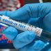 Πρόγραμμα ελέγχων ανίχνευσης covid-19 στον Νομό Τρικάλων