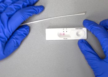 Δευτεριάτικοι έλεγχοι εντοπισμού covid-19 στα Τρίκαλα