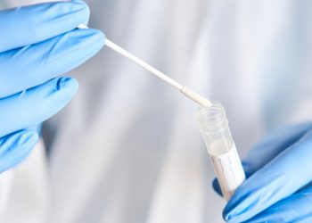 Αποτελέσματα ανίχνευσης covid-19