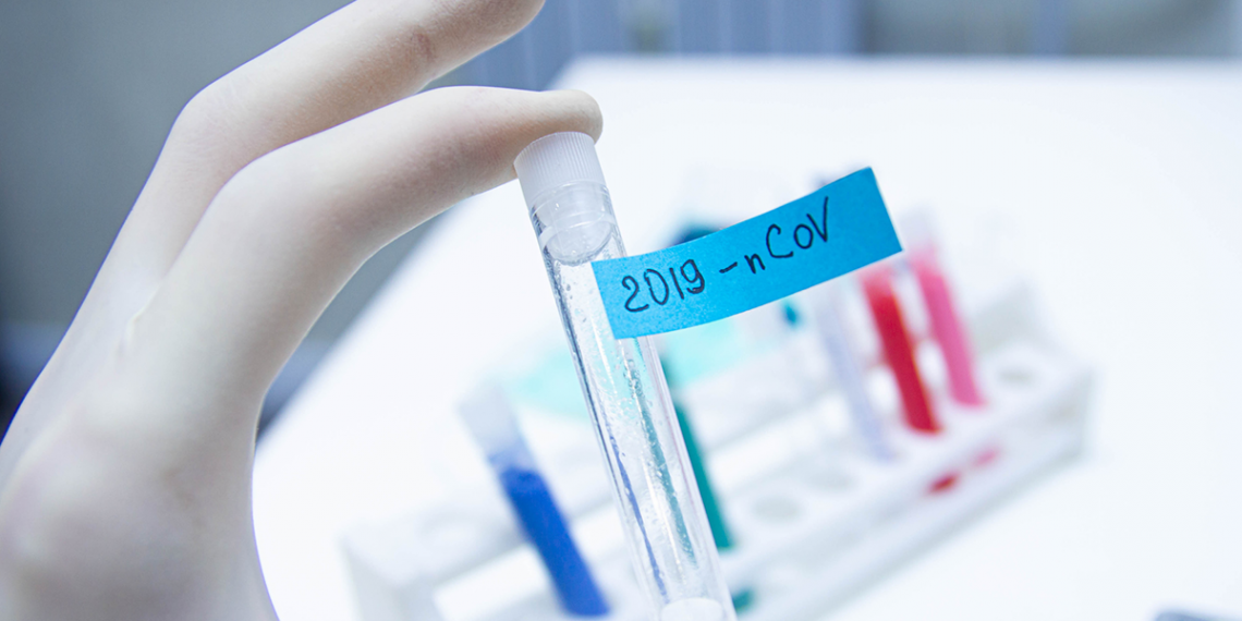 Εντοπισμός 8 κρουσμάτων covid-19 στους ελέγχους στα Τρίκαλα