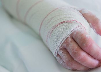 Ληστεία σε οικία και σπασμένο χέρι της παθούσας