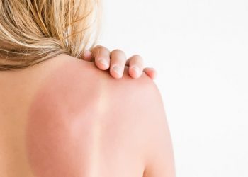 Δράση ενημέρωσης στα Τρίκαλα για τις δερματικές παθήσεις